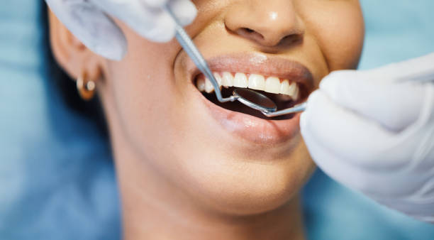 Best Walk-In Emergency Dental Services in Maple Grove, MN